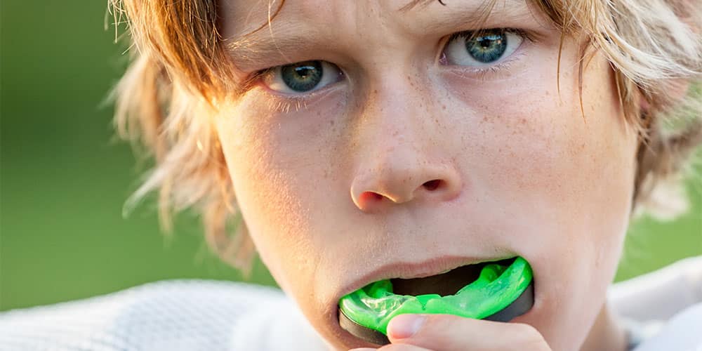 mouthguards wantirna south diamond dental