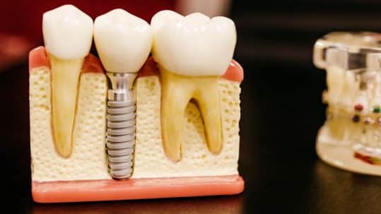 The importance of crown to root and crown to implant ratios